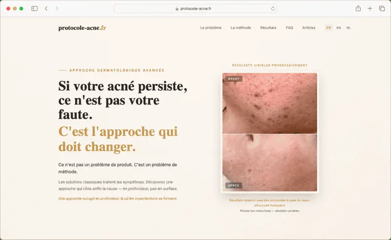 Capture du site Protocole Acné